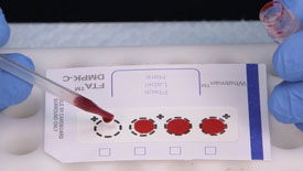 Seroclinix Preparing Dried Spot (DS) Collection Card with whole blood
